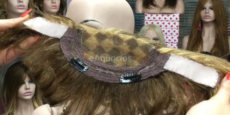 Voluminador de pelo frontal para alopecia en laterales