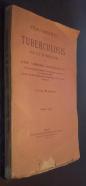 Tratamiento de la tuberculosis por la tuberculina
